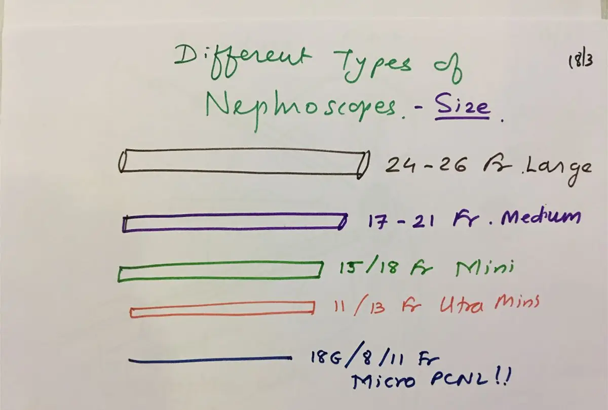 Hand-drawn chart of five bars of decreasing width labelled 24 to 26 Fr large, 17 to 21 Fr medium, 15/18 Fr mini, 11/13 Fr ultra mini, and 18G/8/11 Fr micro PCNL.