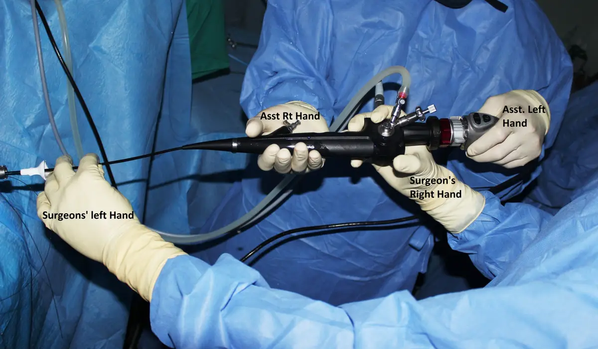 Four gloved hands holding a flexible ureteroscope during surgery, labelled surgeon's left hand, surgeon's right hand, assistant's right hand and assistant's left hand.