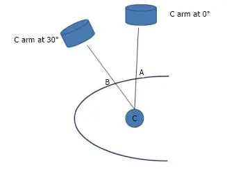 Simple diagram showing an X-ray C-arm at 0 degrees and at 30 degrees, both aimed at the same target point in the kidney.