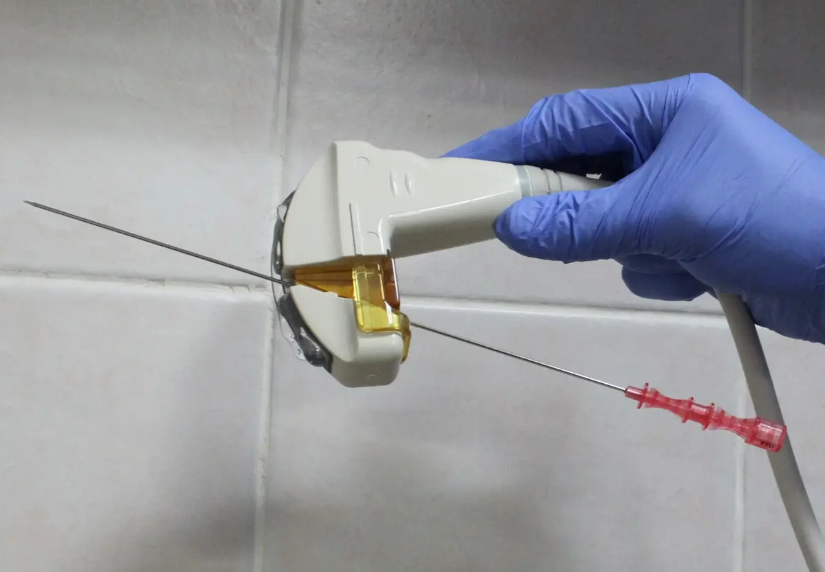 A gloved hand holding an ultrasound probe with a clip-on needle guide, and a long puncture needle passing through the guide at an angle.
