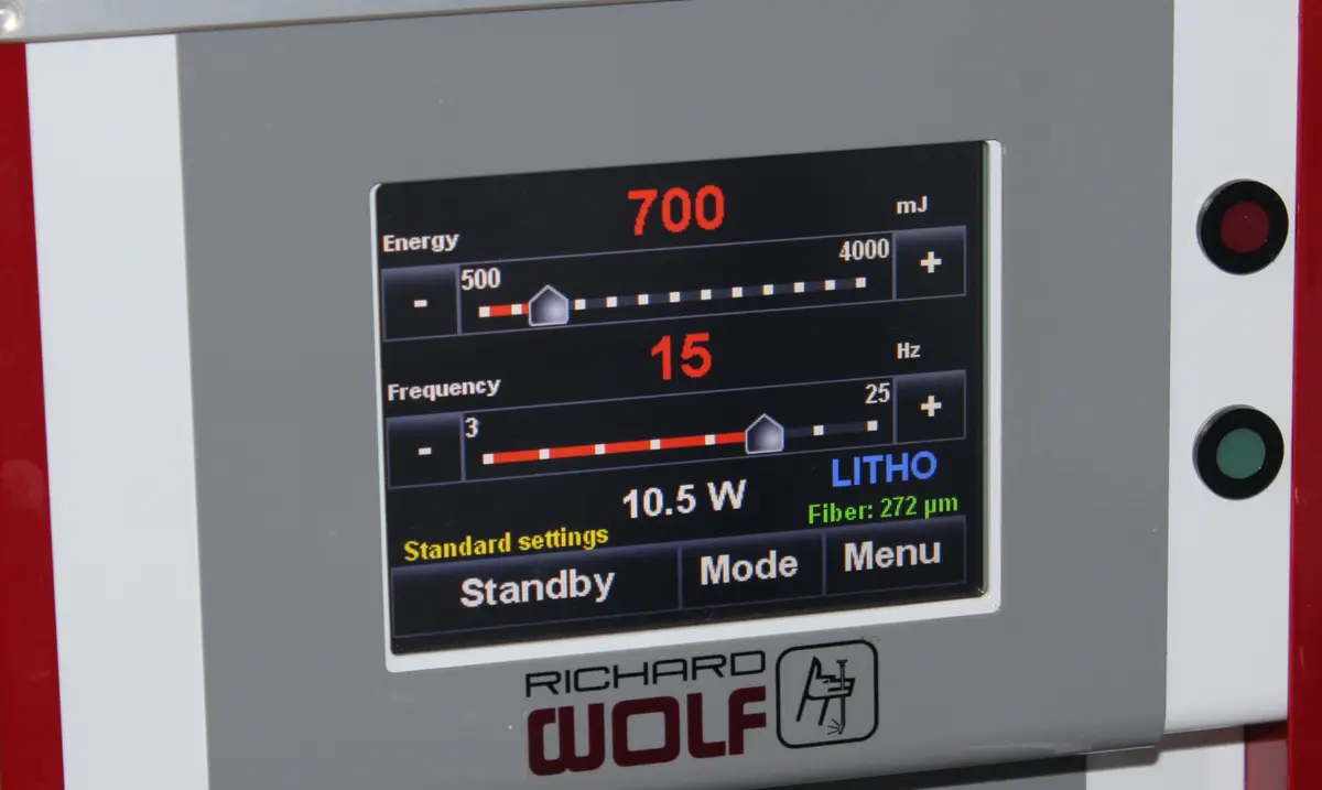 Laser machine display set to lower energy and higher frequency.