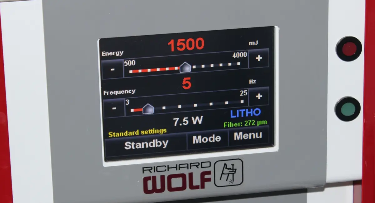Laser machine display set to high energy and low frequency.